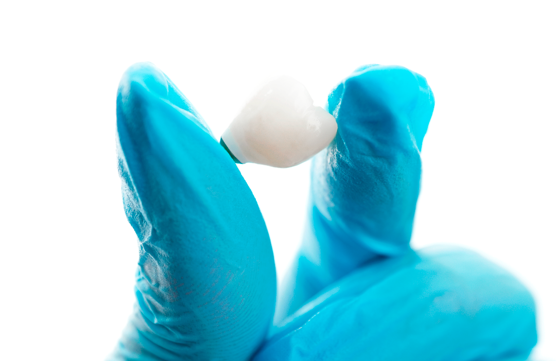 What are dental implants and what are they used for?