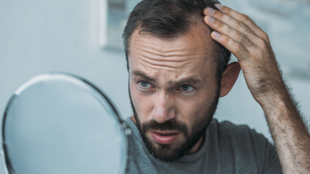 Greffe de cheveux : tout sur la procédure