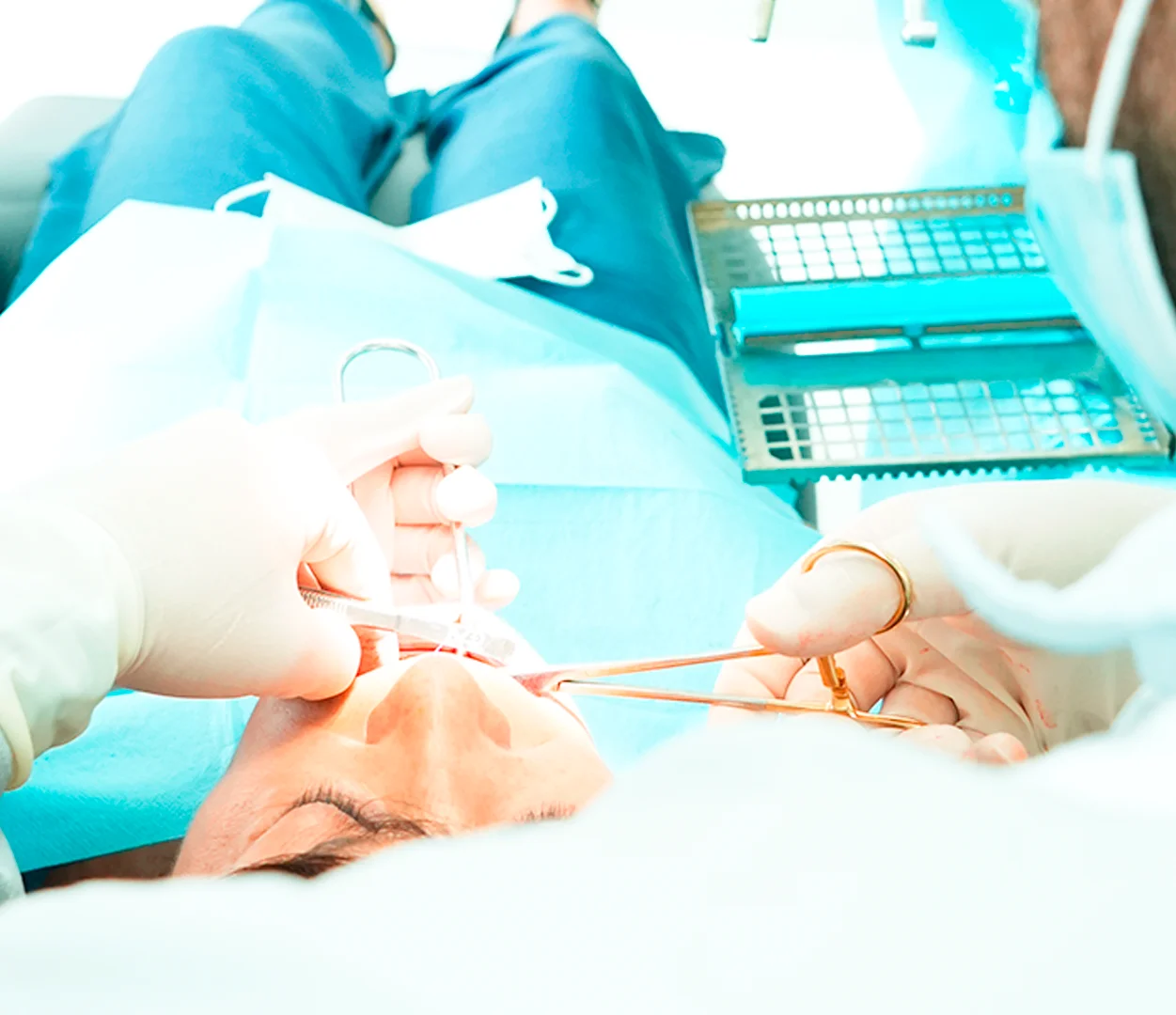 Imagem ilustrativa - Chirurgie Orale et Implantologie